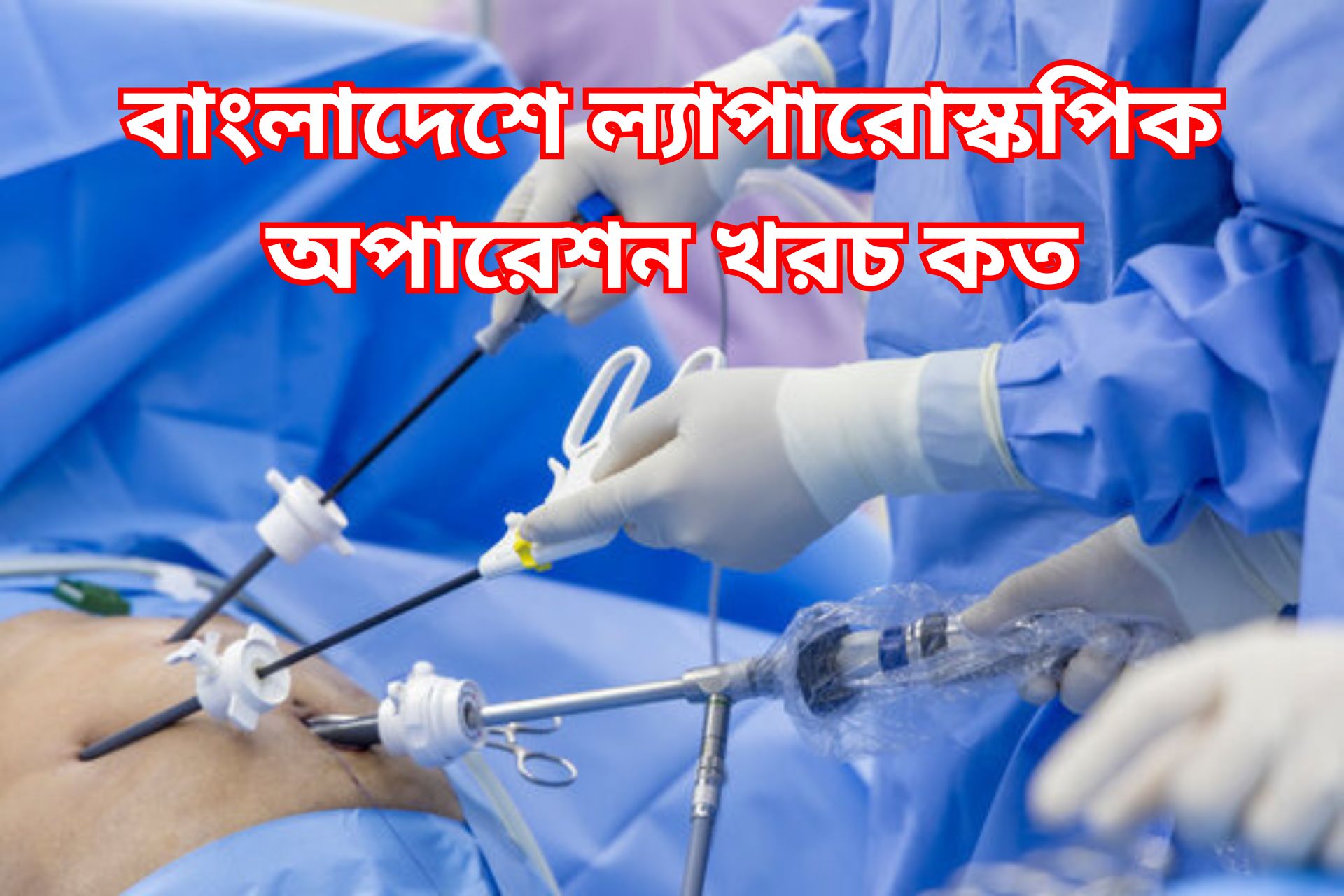 বাংলাদেশে ল্যাপারোস্কপিক অপারেশন খরচ কত